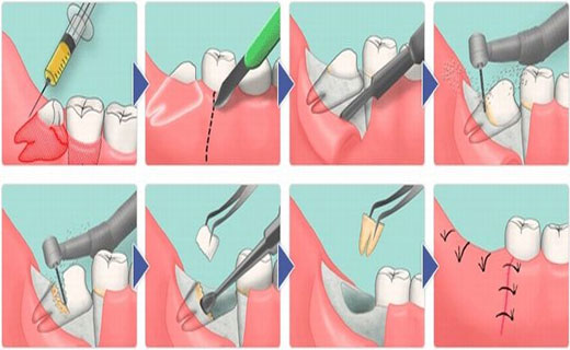 Удаление зуба Томск Вилюйский 1-й стоматология ленина детская томск